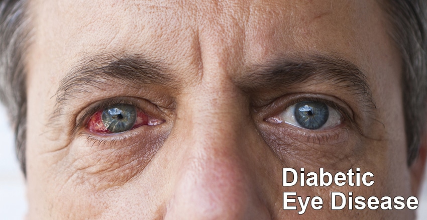 diabetic eye disease treatments